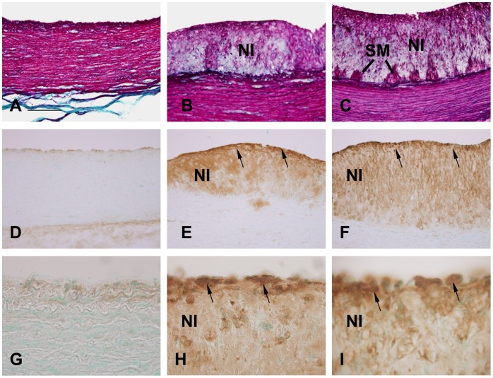 Figure 23