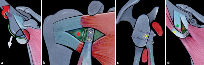 graphic file with name 113_2022_1282_Fig1_HTML.jpg