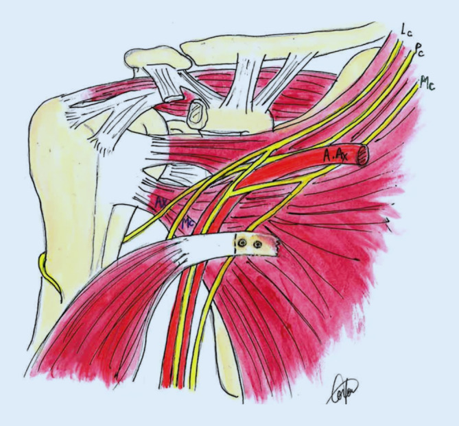 graphic file with name 113_2022_1282_Fig9_HTML.jpg