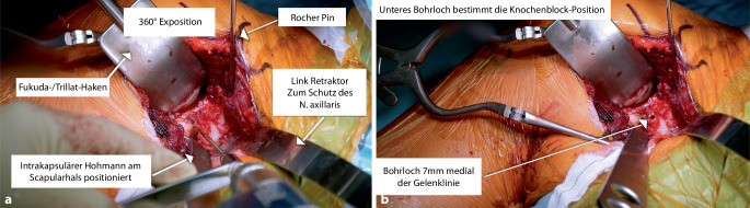 graphic file with name 113_2022_1282_Fig7_HTML.jpg