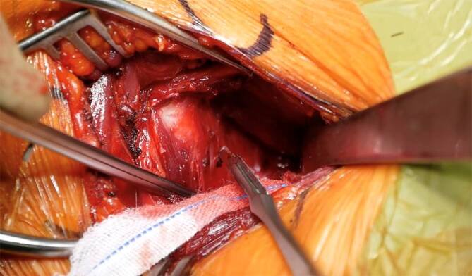 graphic file with name 113_2022_1282_Fig6_HTML.jpg