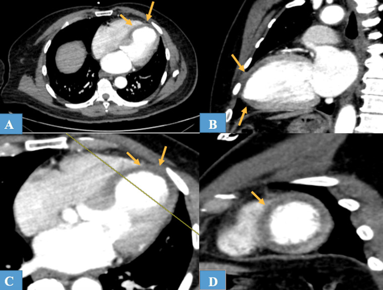 Fig 2