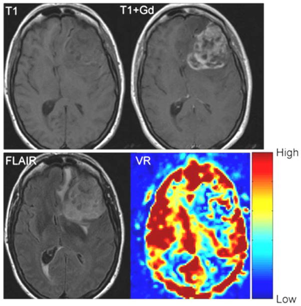 Fig 5