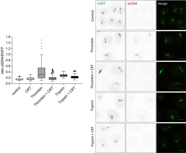 Figure 4—figure supplement 1.