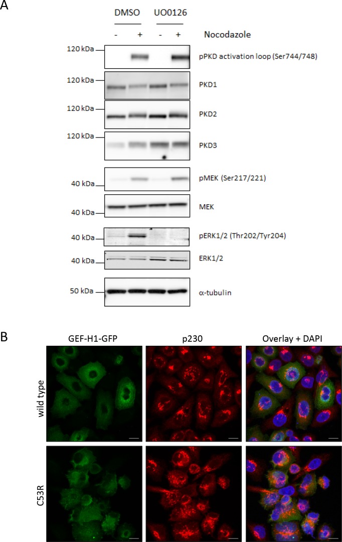 Figure 2—figure supplement 2.