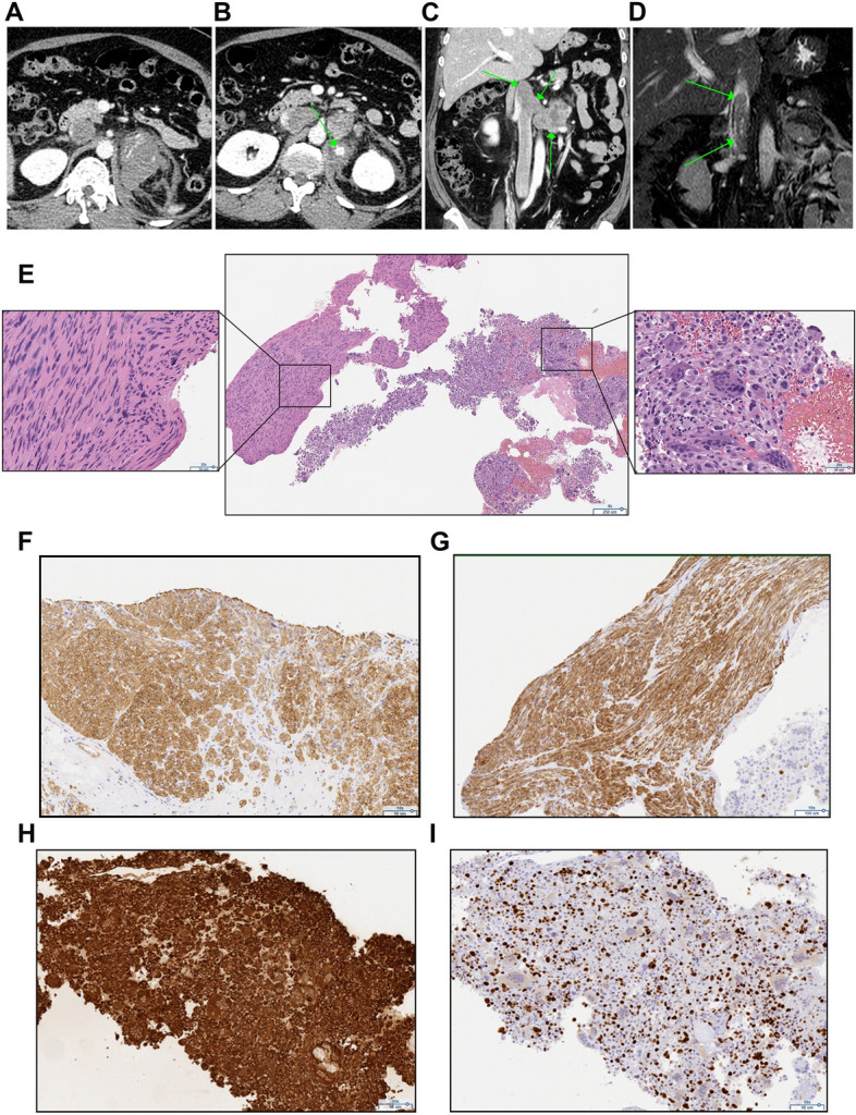 Fig. 2