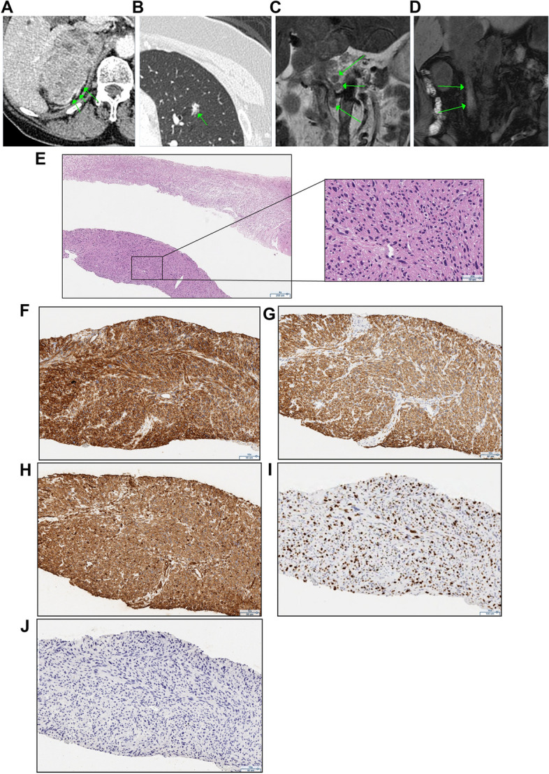 Fig. 1