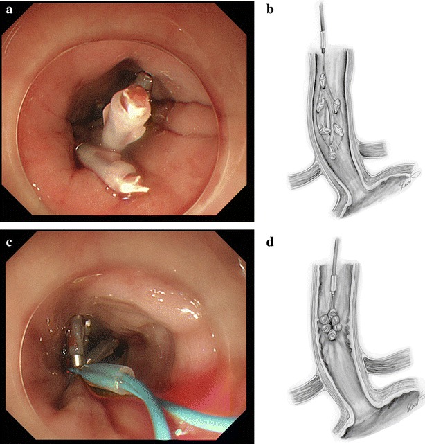 Fig. 3