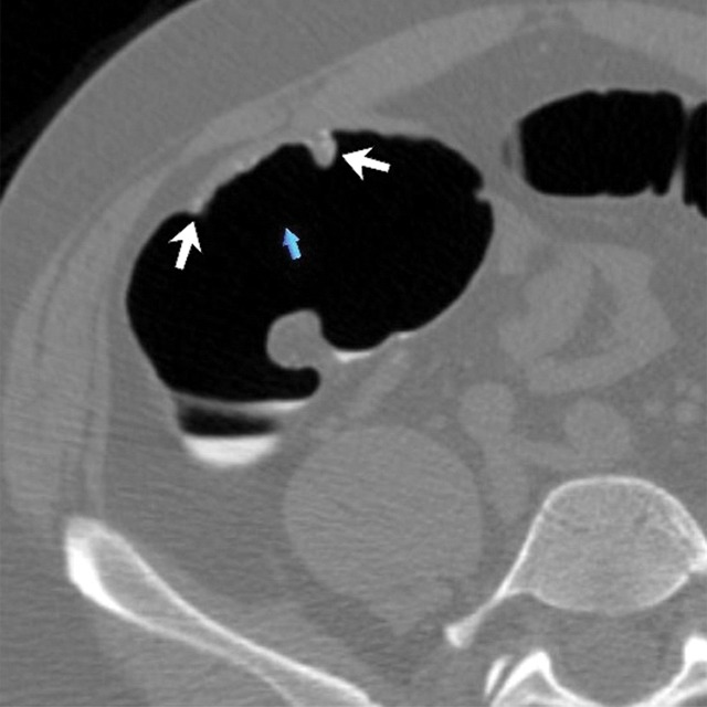 Figure 2c: