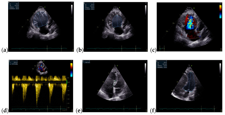 Figure 12