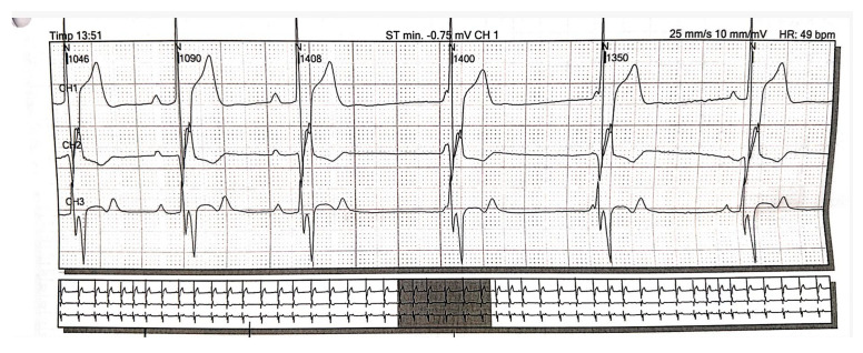 Figure 9