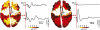 Fig. 2.