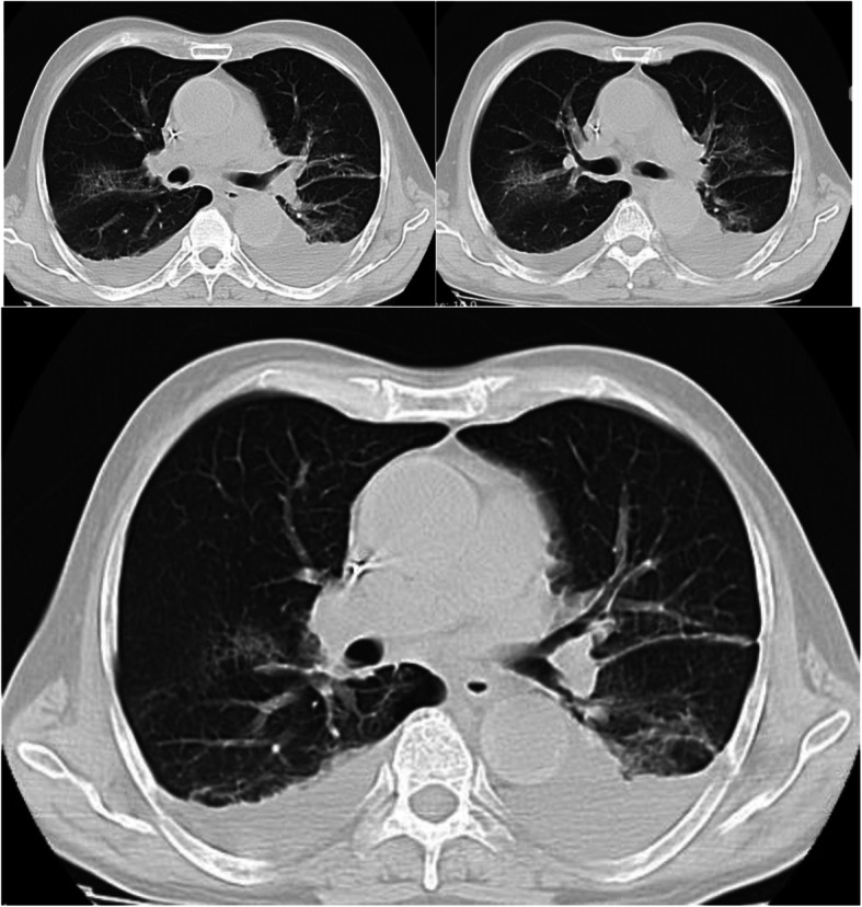 Fig. 3