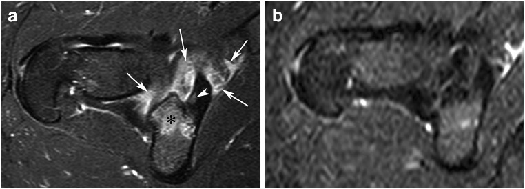 Fig. 12