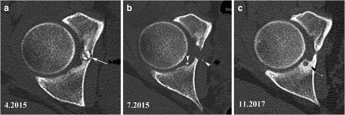 Fig. 10