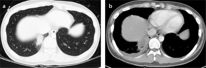 Figure 3. a, b.