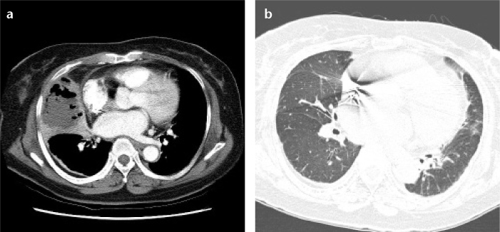 Figure 4. a, b.