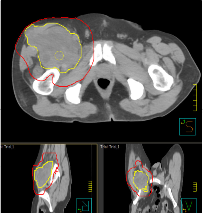 Fig. 2