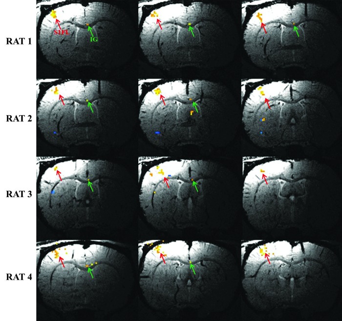 FIG. 3.