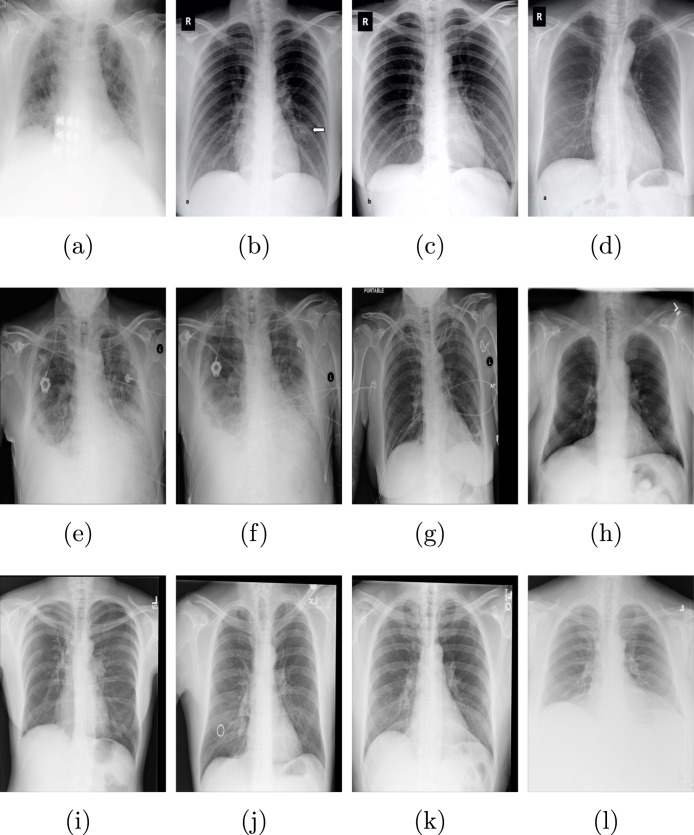 Fig. 10