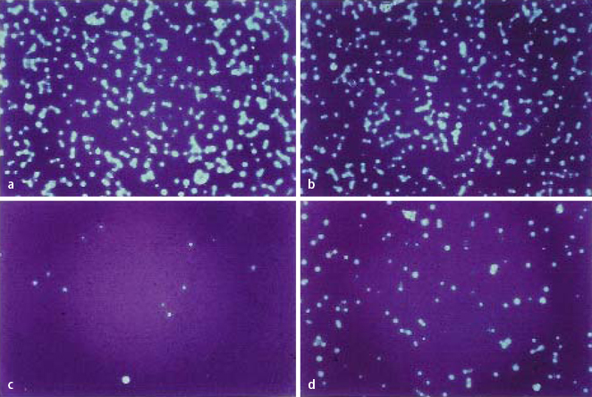 graphic file with name 106_2010_2253_Fig3_HTML.jpg