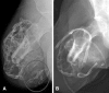 Fig. 3A–B