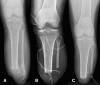 Fig. 5A–C