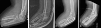 Fig. 4A–D