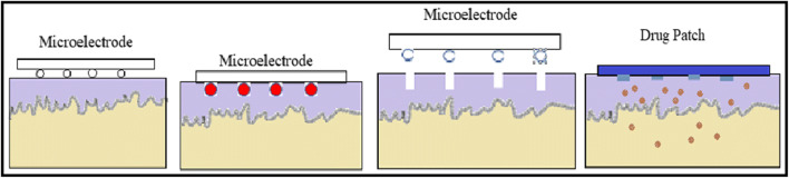 Fig. 5