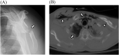 Fig. 32
