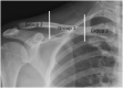 Fig. 28