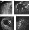 Fig. 21