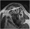 Fig. 19