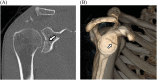 Fig. 31