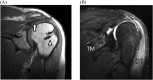 Fig. 22