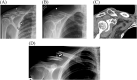 Fig. 29