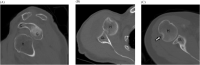 Fig. 11