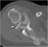 Fig. 13