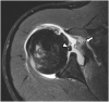 Fig. 17