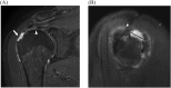 Fig. 18
