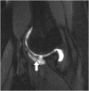 Fig. 16
