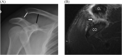 Fig. 25