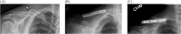 Fig. 30