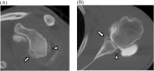 Fig. 12