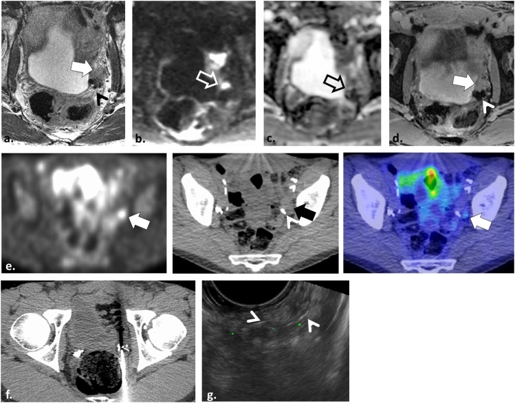 Figure 11.