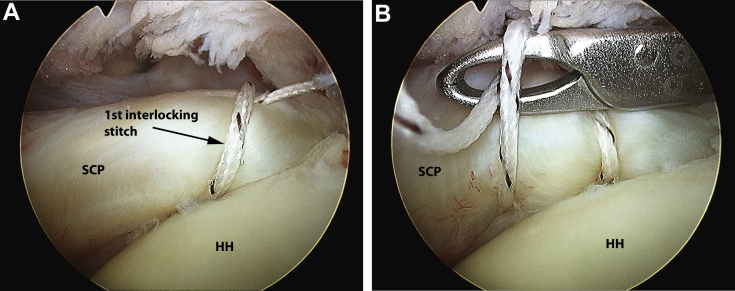 Fig 4