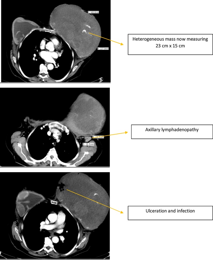 Fig. 4