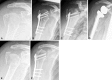 Fig. 4A–F