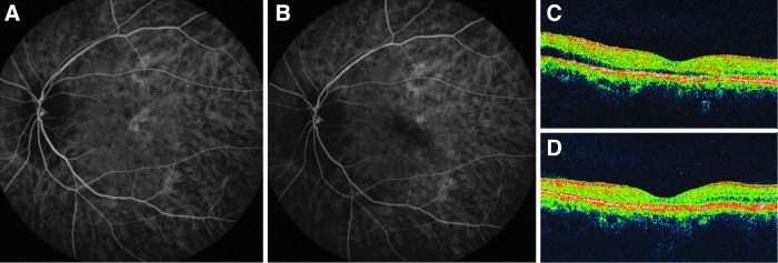 FIG. 1.