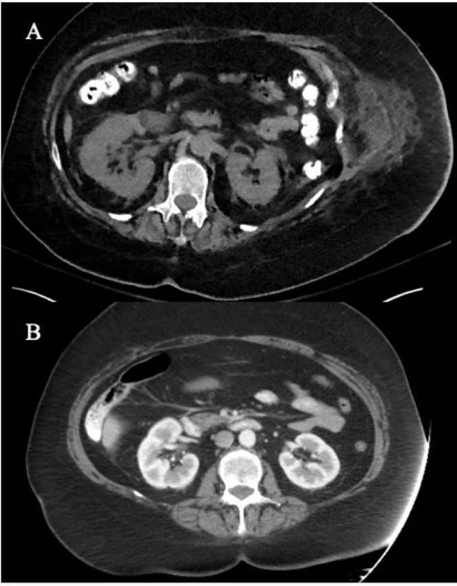 Figure 1